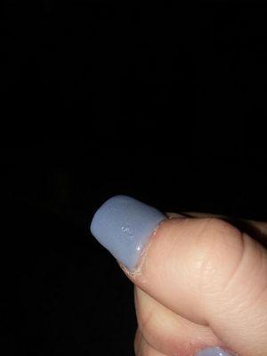 There is a hole looking thing in the middle of this thumb and the whole nail looks bumpy