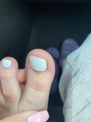 Big toe messed up