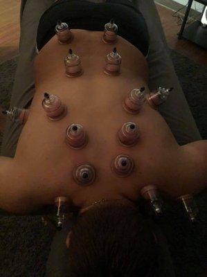 Our athletes love cupping!!!