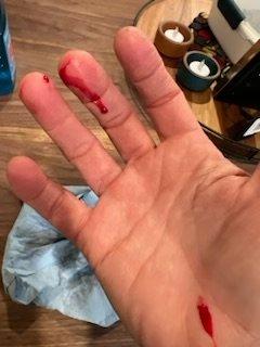 Clients repeatedly cut their hand when opening the fridge.