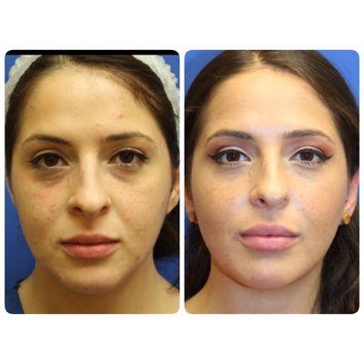 ENHANCE Facial Contouring by Dr. Irene Gladstein