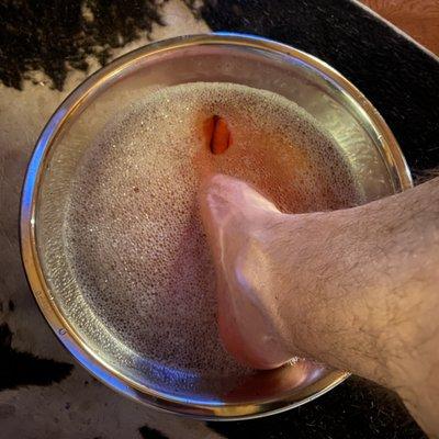 Toe bath in iodine solution