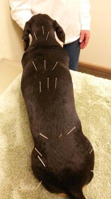 Acupuncture