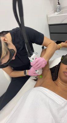 Laser hair removal (underarms)