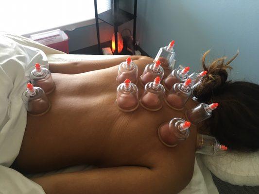 Cupping therapy for pain and detoxification.