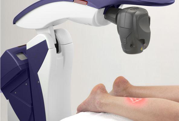 The M6 Robotic Class 4 Laser is a featured therapy for chronic pain at MVC.