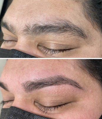 Before and after Men's Brow