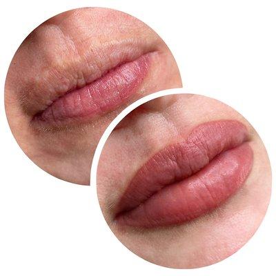 Lips contour correction