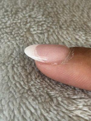 Hair IN nail