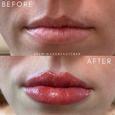 Lip Shading