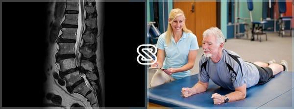 The SpineZone Program includes isolated strengthening and stretching protocols that reduce the symptoms associated with Stenosis