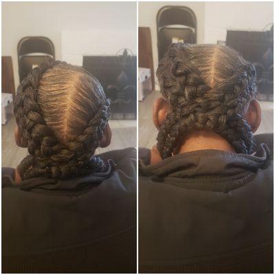 Double goddess feed-in braids on client with alopecia.