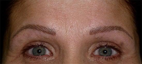 Newly done permanent eyebrows. Color will soften in about one week.