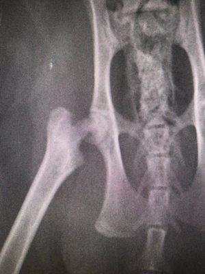 Here are the X-rays - you can see how the head of his femur is wasting away