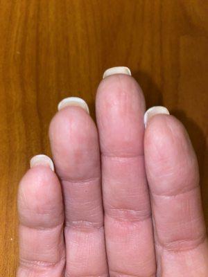 Stained under nails right after being filled