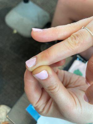 Missing the sides of the nail