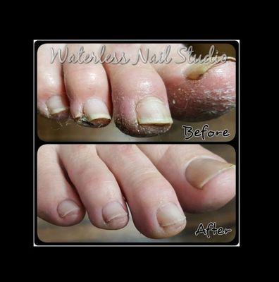 Waterless Pedicure Treatment