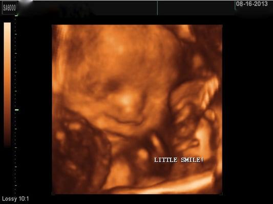 One of TomorrowToday Ultrasound's happy babies!