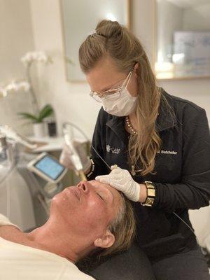 Dr. Batcheller Performing PRF Microneedling Vampire Facial