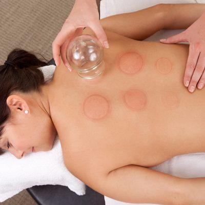 Cupping removes energy stasis and helps resolve pain.  Included in acupuncture treatments at no additional cost, as needed.