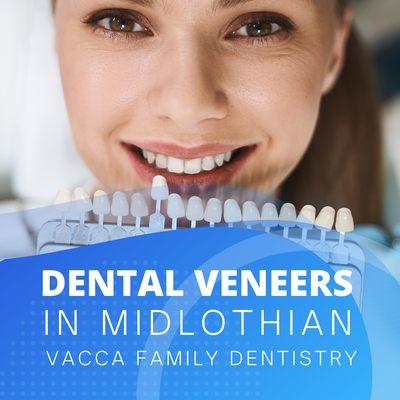 Dental veneers in Midlothian VA