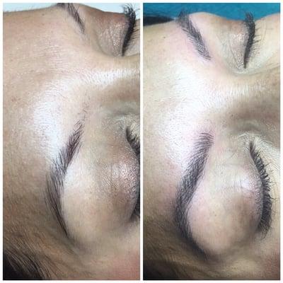 Microblading