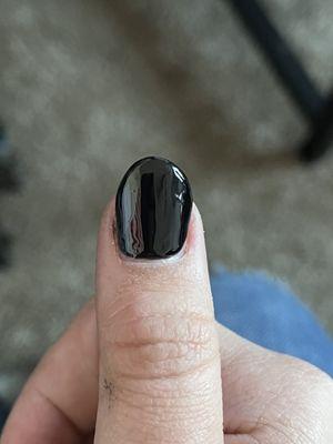 My thumb isn't an even shape all around the nail.