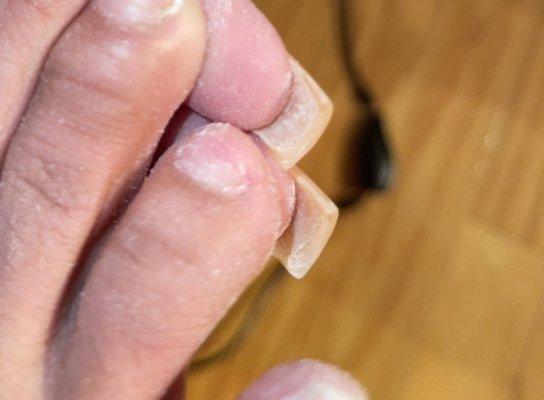 Ripped nail during "soak" off