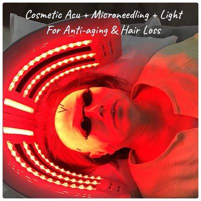 Adding red light to cosmetic acupuncture and microneedling increases the results. Improve your skin and regrow your hair