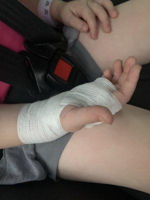 2 year old had to get stitches after puncture wound from exposed tac.