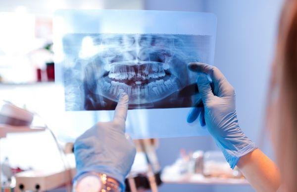 Titanium Dental Implants and Periodotics