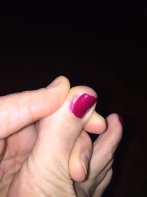 That entire angled area used to have a toenail!  That is how extreme she was with the nippers.