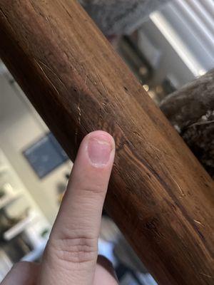 Update on 9/17. Top part of nail has fallen off.