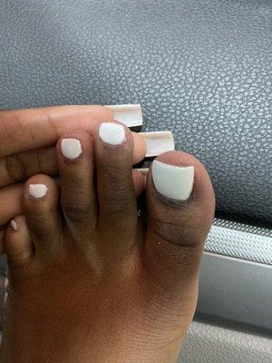 Sloppy pedicure