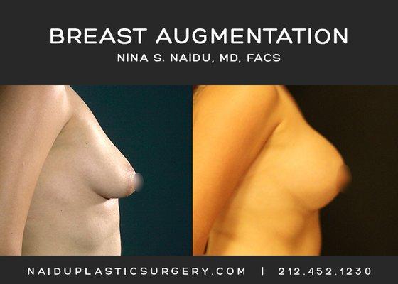 Nina S. Naidu, MD FACS  (212) 452-1230  http://www.naiduplasticsu­rgery.com   IG: https://www.instagram.com/drnaidu_plasticsurger­y/