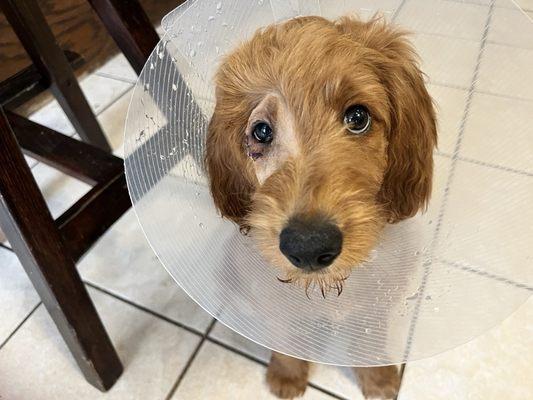 Dr. Lee did a wonderful job helping little Finley he had an inverted lower eyelid. He is much happier and it grew in beautifully.