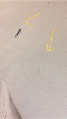 Pubic and human hair on pillow sheets