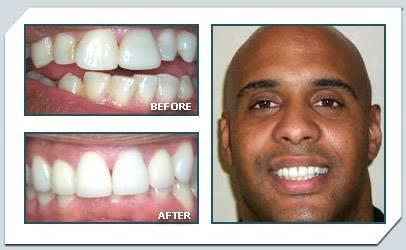 A beautiful smile makeover and another very happy patient!