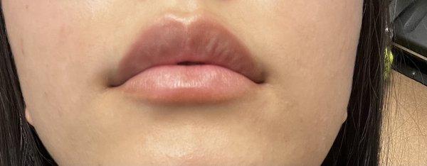 What my lips look like now