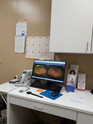 Immediate retina map results in real time!