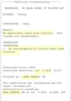 June 6th by CLEVELAND CLINIC: NO NASAL FRACTURE