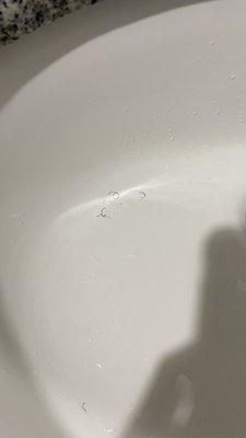 Hairs in the sink upon check in