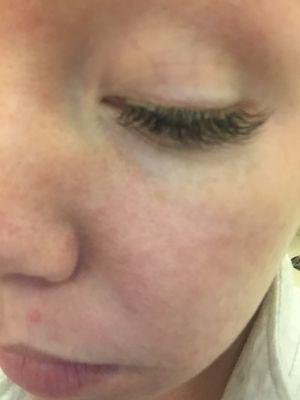 This was 2-3 hours after my eyelash extension service- so crooked and looks like 2 weeks grown out. So disappointed.