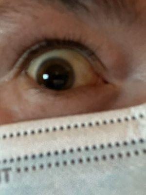 Dilated to see you