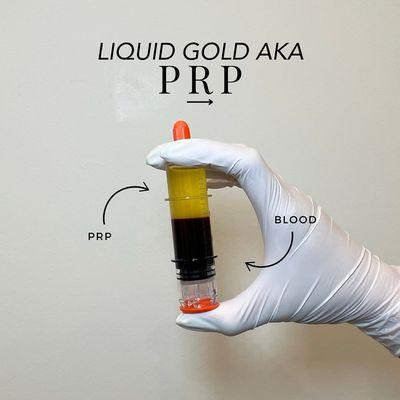 What is PRP, and why do we call it Liquid Gold? Swipe to find out!