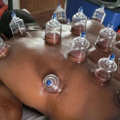 Cupping