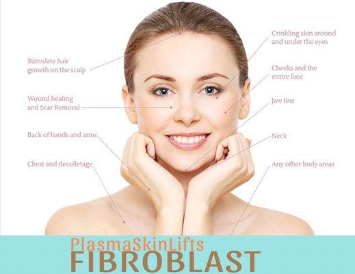 Fibroblast Plasma Skin Tightening