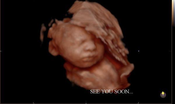 4D ultrasound at 29 weeks, 5 days