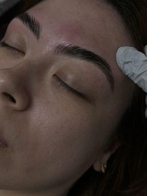 Bespoke Brow Lift