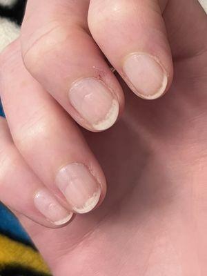 Grooves in my nails after gel removal